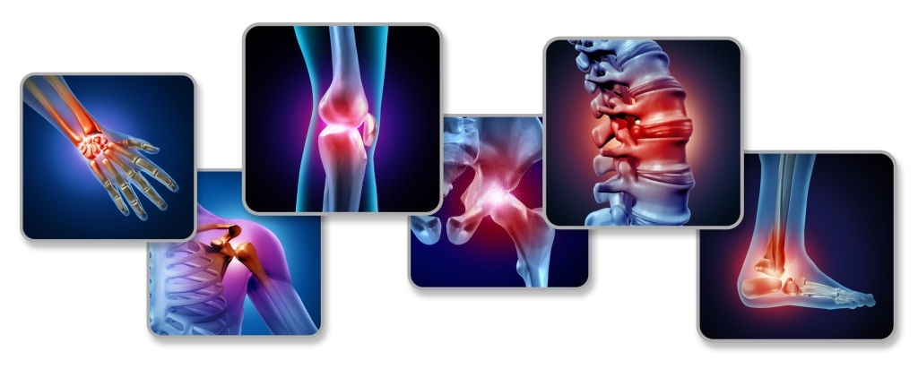 Pain of the joints concept as skeleton and muscle anatomy of the body with a group of sore joints as a painful injury or arthritis illness symbol for health care and medical symptoms with 3D illustration elements.